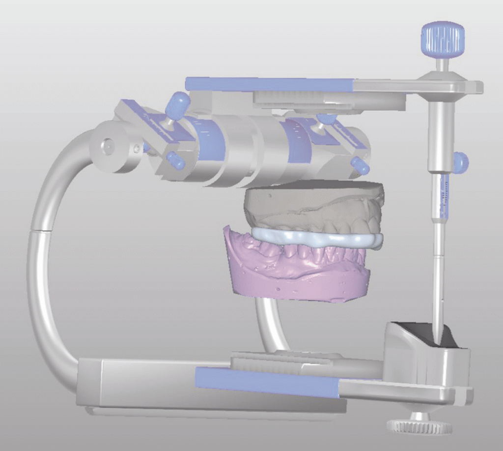Inman Ortho Digital Mount Image